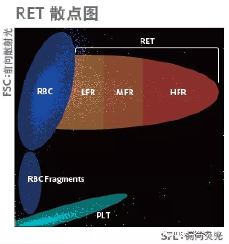 rbc直方图怎么看【小结】常见血细胞分析仪的检测原理与直方图／散点图_https://www.jmylbn.com_新闻资讯_第24张