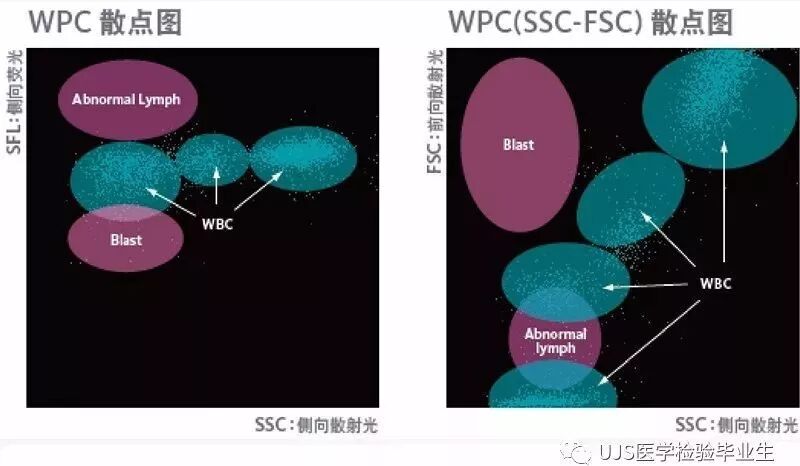 rbc直方图怎么看【小结】常见血细胞分析仪的检测原理与直方图／散点图_https://www.jmylbn.com_新闻资讯_第22张