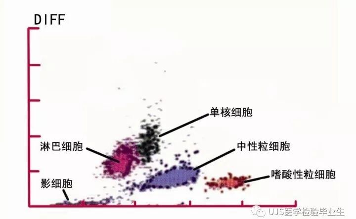 rbc直方图怎么看【小结】常见血细胞分析仪的检测原理与直方图／散点图_https://www.jmylbn.com_新闻资讯_第13张