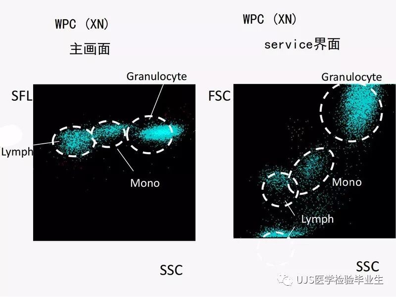 rbc直方图怎么看【小结】常见血细胞分析仪的检测原理与直方图／散点图_https://www.jmylbn.com_新闻资讯_第23张