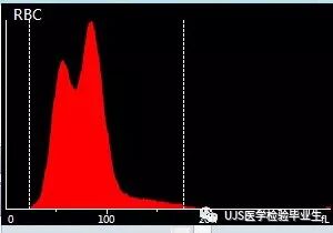 rbc直方图怎么看【小结】常见血细胞分析仪的检测原理与直方图／散点图_https://www.jmylbn.com_新闻资讯_第7张