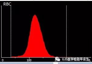 rbc直方图怎么看【小结】常见血细胞分析仪的检测原理与直方图／散点图_https://www.jmylbn.com_新闻资讯_第6张