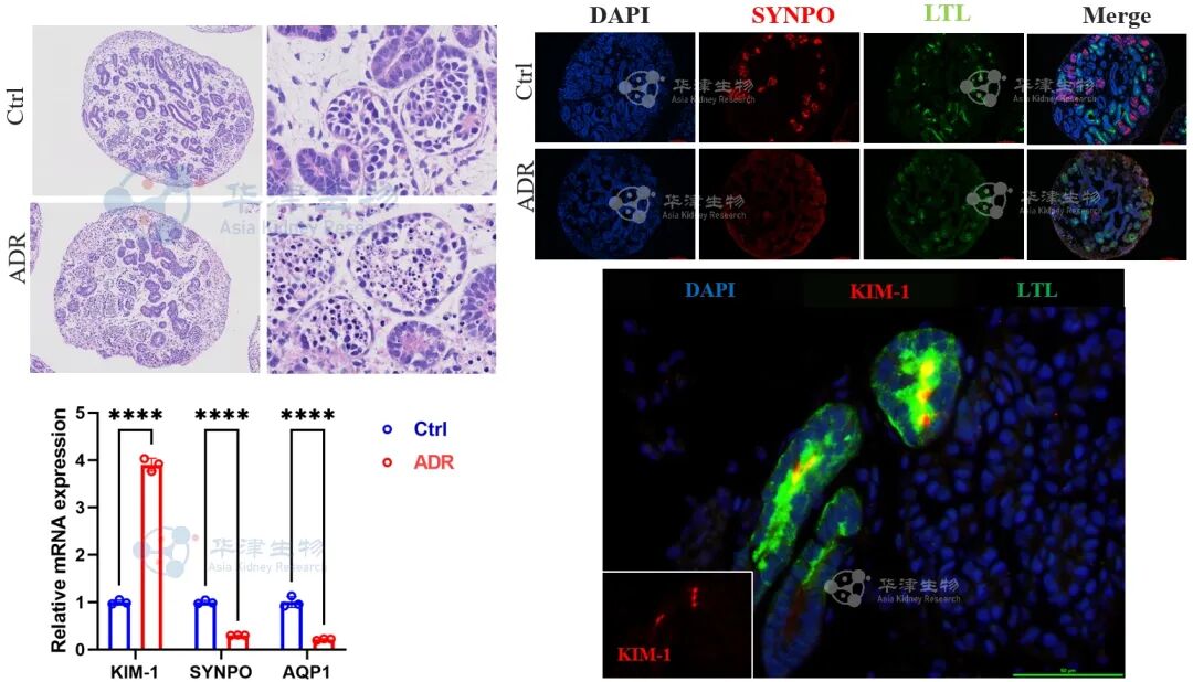 阿霉素诱导肾损伤类器官模型检测结果