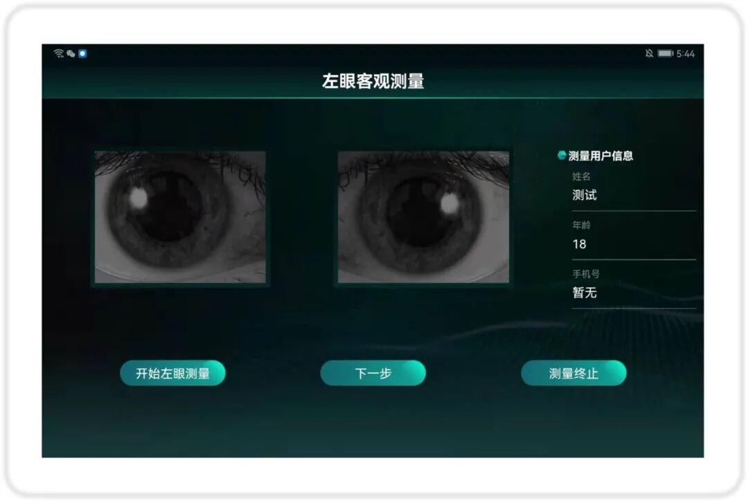 国产验光仪什么牌子好获批上市！国产新型双眼波前验光仪_https://www.jmylbn.com_新闻资讯_第5张