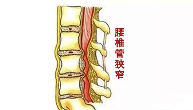 腿疼 无力 走路一瘸一拐 中医针灸显奇效 可惜知道的人太少了 患者印像 北京同仁堂石家庄中医医院