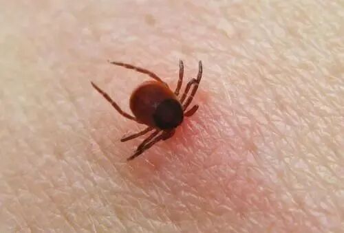 那些“千奇百怪”的虫咬皮炎