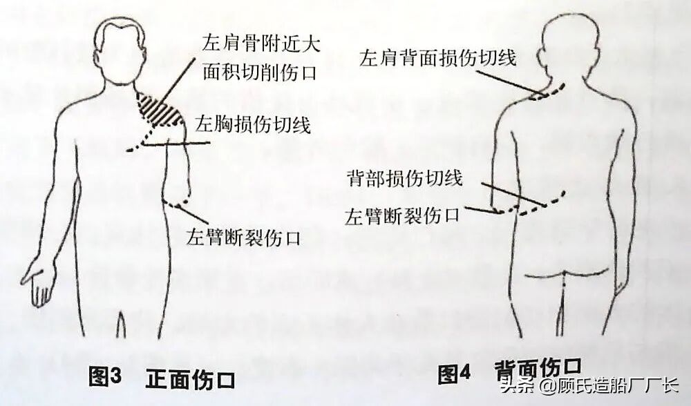 命丧螺旋桨下的飞行学员，记中飞院2013年机场地面事故的图16
