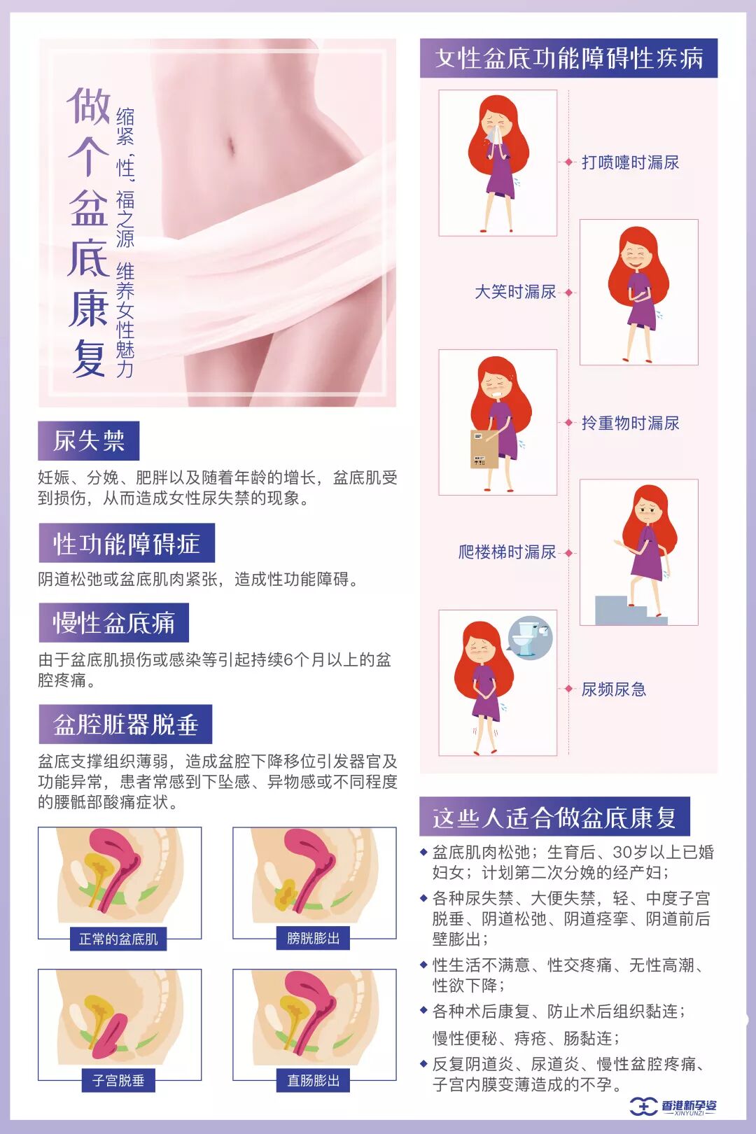 产后漏尿两年了，再做盆底肌修复还有效吗？