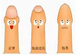 犹太人为什么要割包皮_割人为犹太包皮要多少钱_割人为犹太包皮要多长时间