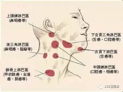 2,改善因淋巴代謝受阻引起的頸部膚色暗沉,息肉,扁平疣等