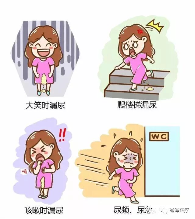 一胎不修復(fù)，二胎癥狀重|產(chǎn)康資訊-廣州通澤醫(yī)療科技有限公司