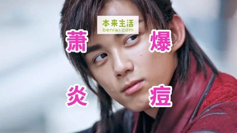 心疼吴磊！《斗破苍穹》变《痘破苍穹》，剧组到底给他吃了什么？