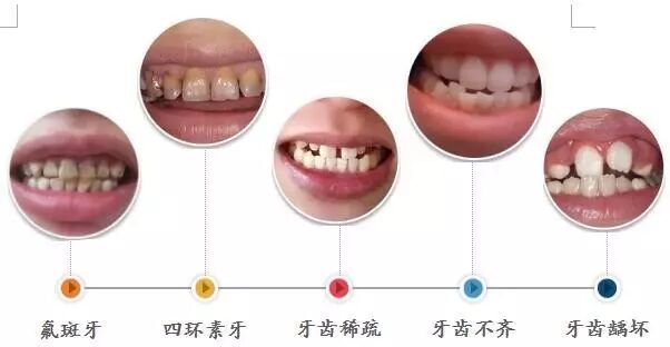 你还不知道牙齿美学修复？那就太low了！
