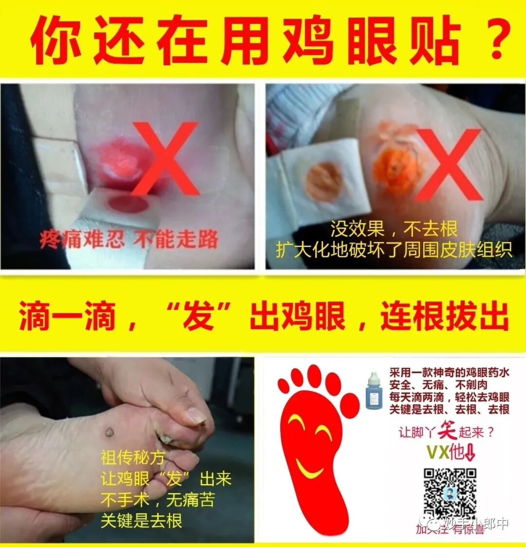 鸡眼怎样算拔干净了