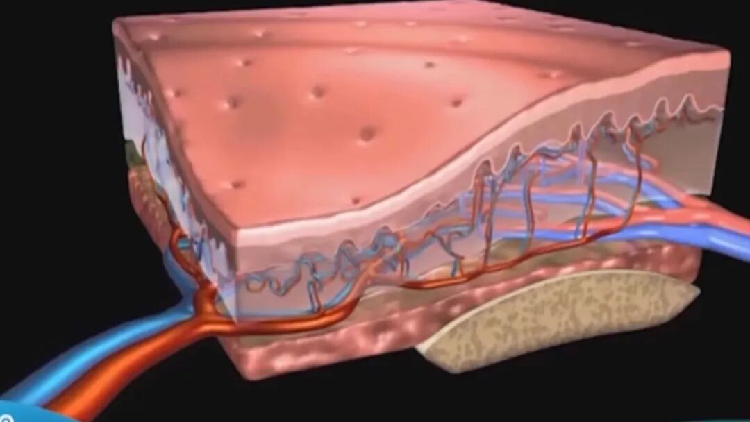 病人滑移垫怎么用健康面对面：压力性损伤_https://www.jmylbn.com_新闻资讯_第2张