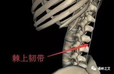 全！腰背痛常見病症康復方案 健康 第5張