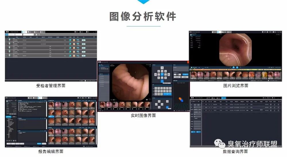 胃镜有哪些型号胃镜、肠镜、胶囊内镜—6种消化内镜介绍_https://www.jmylbn.com_新闻资讯_第6张