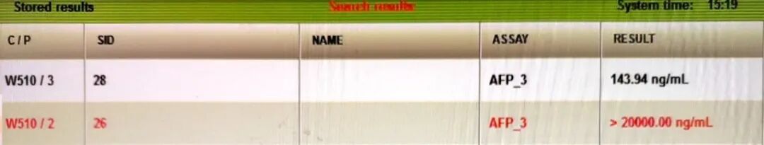 生化怎么通样本针肿瘤标志物检测结果异常？问题究竟出在哪里？_https://www.jmylbn.com_新闻资讯_第3张