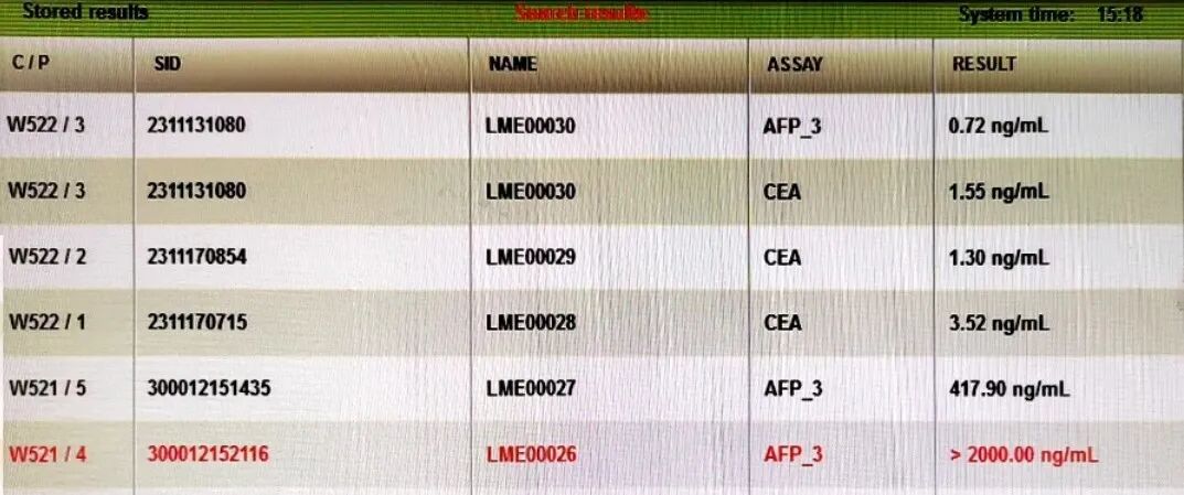 生化怎么通样本针肿瘤标志物检测结果异常？问题究竟出在哪里？_https://www.jmylbn.com_新闻资讯_第2张