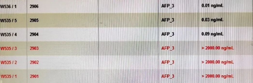 生化怎么通样本针肿瘤标志物检测结果异常？问题究竟出在哪里？_https://www.jmylbn.com_新闻资讯_第6张