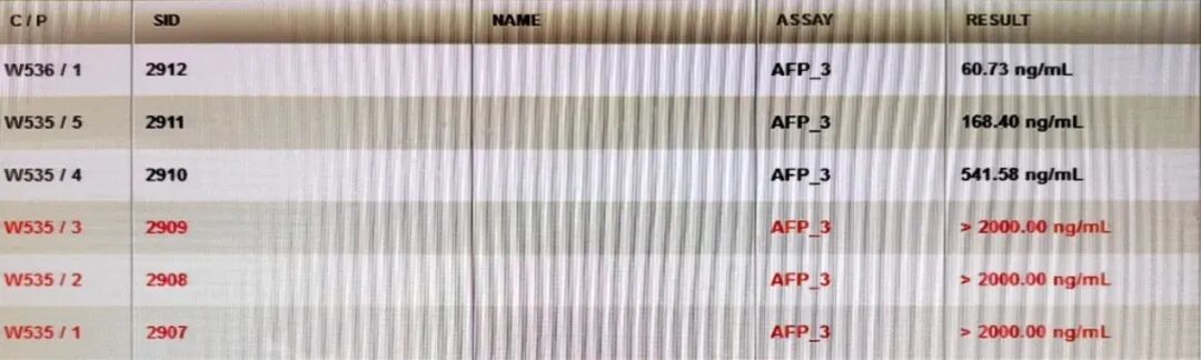 生化怎么通样本针肿瘤标志物检测结果异常？问题究竟出在哪里？_https://www.jmylbn.com_新闻资讯_第7张