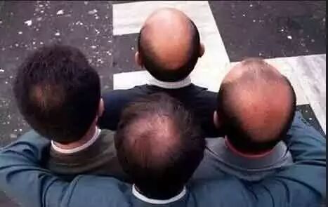 脱发、秃顶、发际线高、前额光秃...据说，它能让掉了的头发重新长出来！