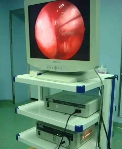 耳朵内窥镜什么样耳朵的专属医生——耳纤维内窥镜_https://www.jmylbn.com_新闻资讯_第5张