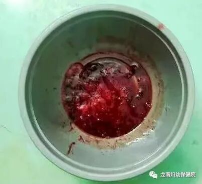 内镜夹怎么不掉【胃镜室病例】贲门出血“夹”然而止，消化内镜显神通_https://www.jmylbn.com_新闻资讯_第5张