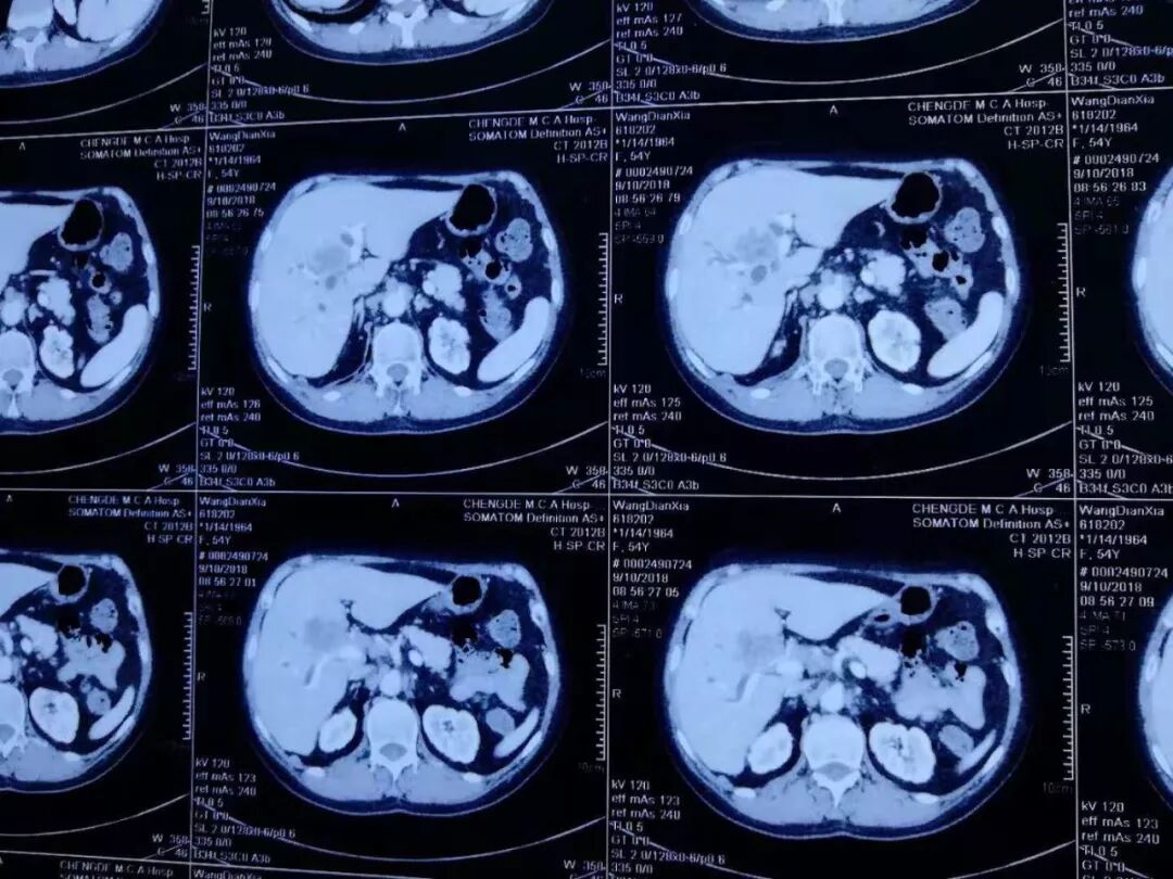 臭氧治疗什么病三氧自体血疗法开启“慢性病、肿瘤”治疗新篇章_https://www.jmylbn.com_新闻资讯_第13张