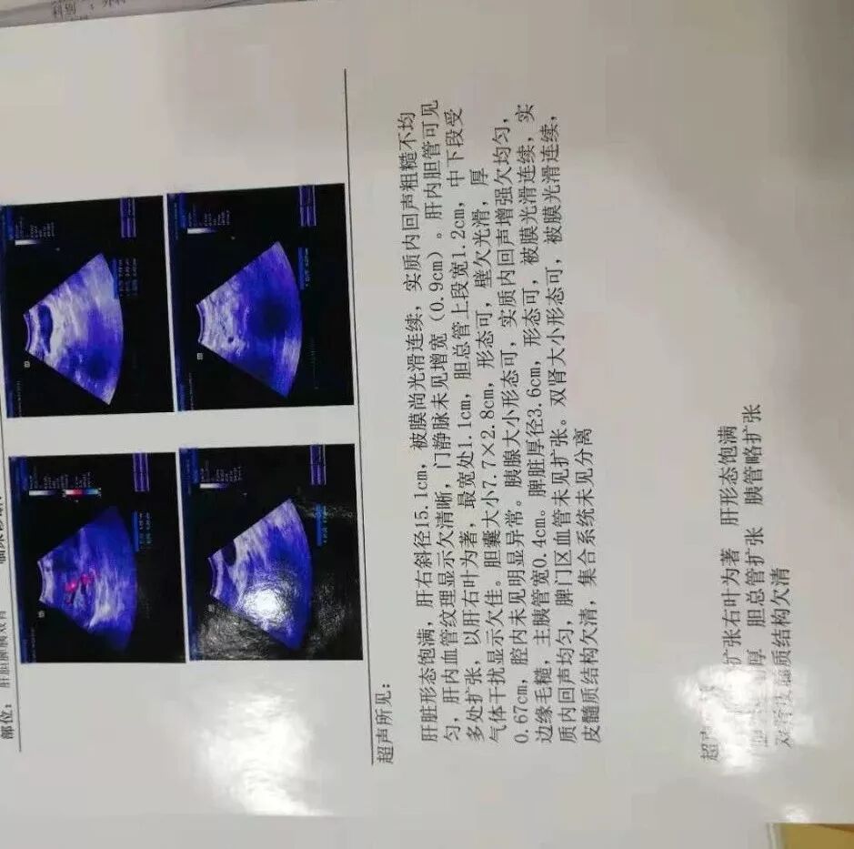 臭氧治疗什么病三氧自体血疗法开启“慢性病、肿瘤”治疗新篇章_https://www.jmylbn.com_新闻资讯_第14张