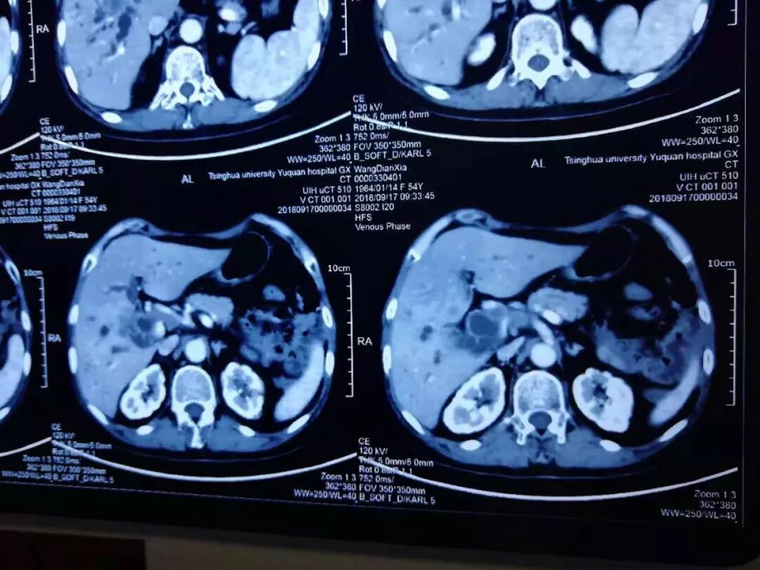 臭氧治疗什么病三氧自体血疗法开启“慢性病、肿瘤”治疗新篇章_https://www.jmylbn.com_新闻资讯_第12张