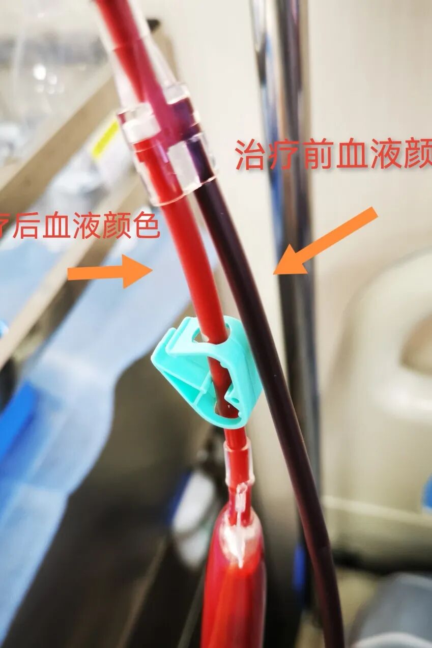 三氧疗法怎么代理三氧疗法是国内外一种纯天然无副作用的绿色疗法——您知道吗_https://www.jmylbn.com_新闻资讯_第2张