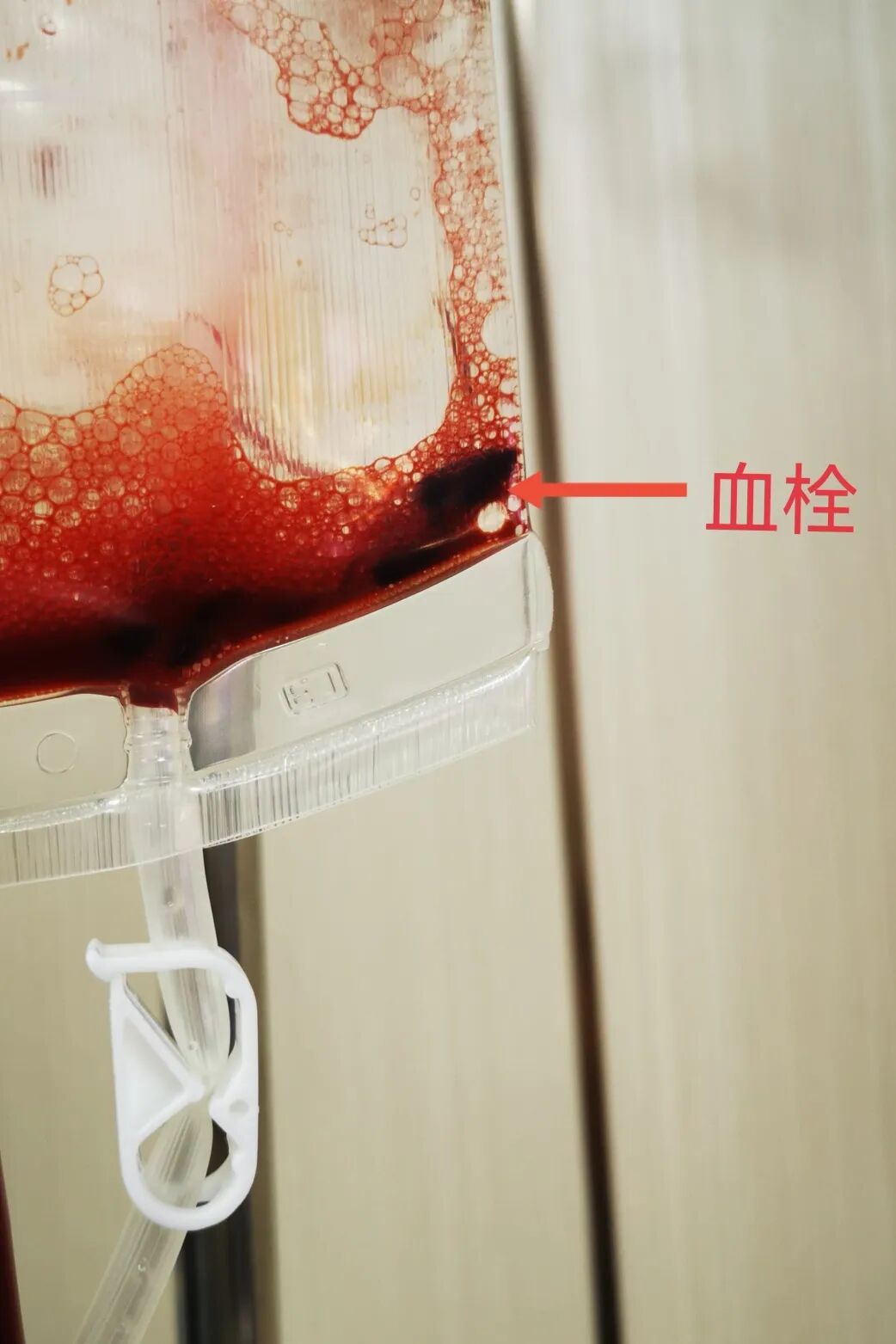 三氧疗法怎么代理三氧疗法是国内外一种纯天然无副作用的绿色疗法——您知道吗_https://www.jmylbn.com_新闻资讯_第3张