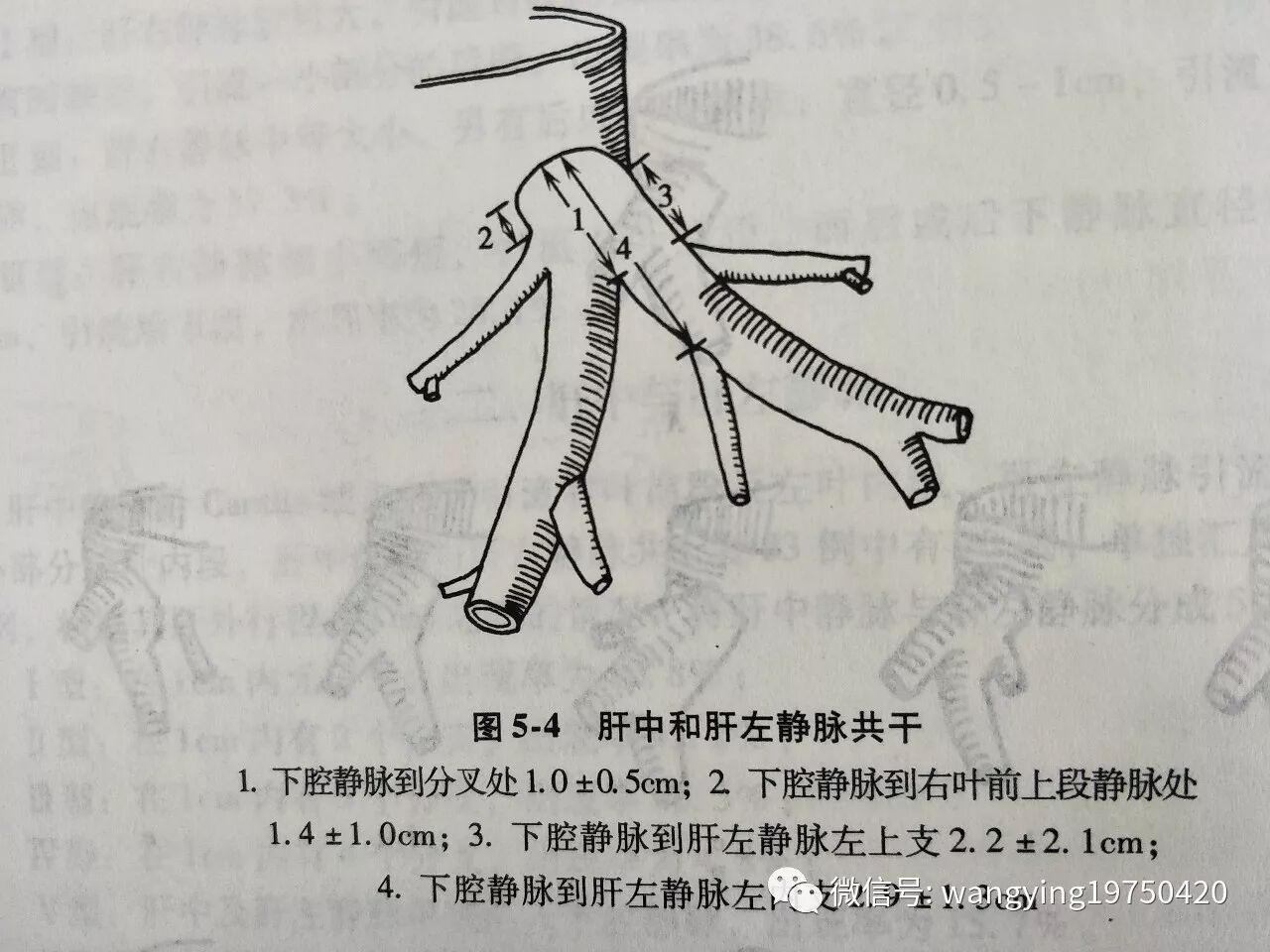 漫谈肝脏的解剖之肝静脉的解剖 - 丁香园论坛