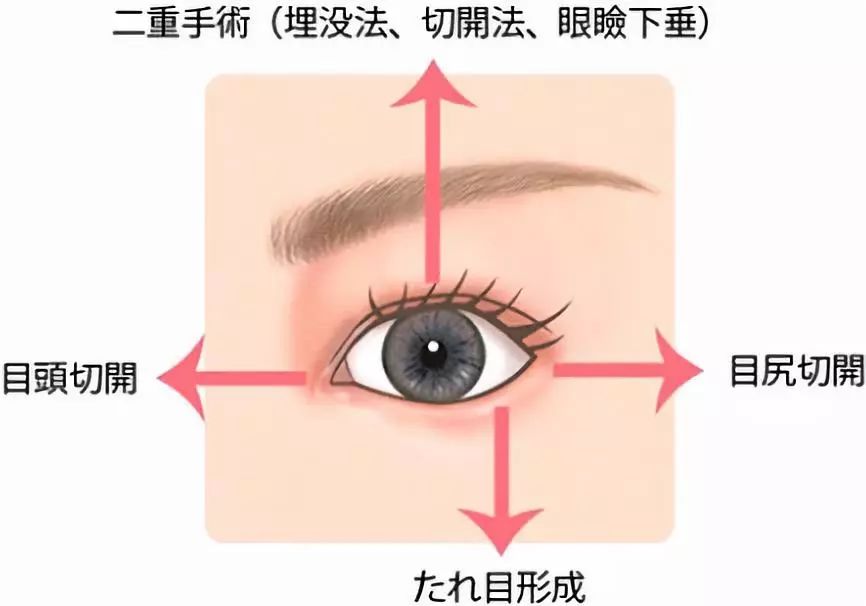 日本女孩子都喜欢做哪些医疗美容项目 信息王 微信公众号文章阅读 Wemp