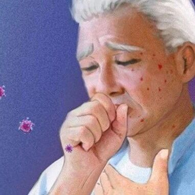 艾滋病病毒入侵人体的全过程曝光