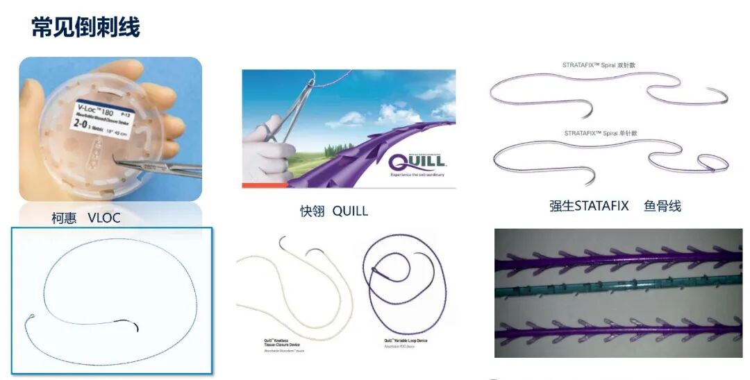 倒刺线怎么缝合TA的名字：倒刺线_https://www.jmylbn.com_新闻资讯_第6张