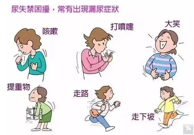 激光治疗仪能治什么病[关爱女性健康] 我院引进“润蜜丽”私密激光系统二氧化碳激光治疗仪解决女性患者疾病_https://www.jmylbn.com_新闻资讯_第7张