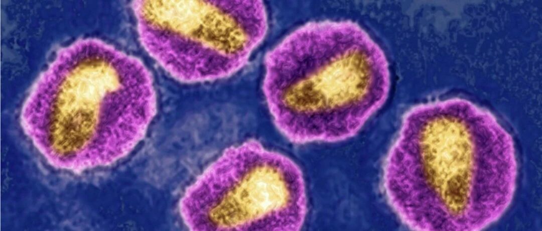 “史上最强”艾滋病毒被发现，已致109人感染