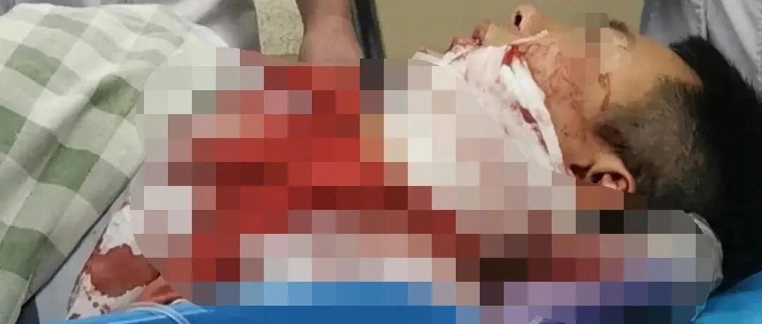 福建一眼科医生疑遭患者割伤，警方已介入