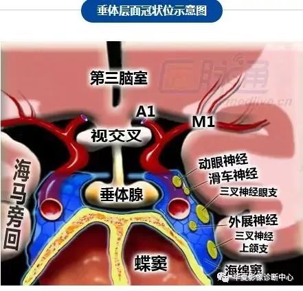 腦部斷層內囊willis環前聯合垂體海馬圖譜