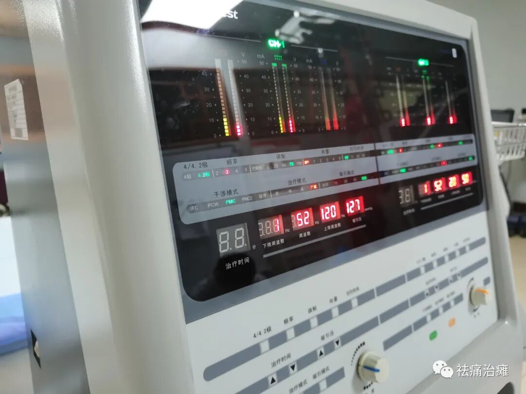 干扰治疗仪怎么使用干扰电治疗仪——“祛痛法宝”_https://www.jmylbn.com_新闻资讯_第9张