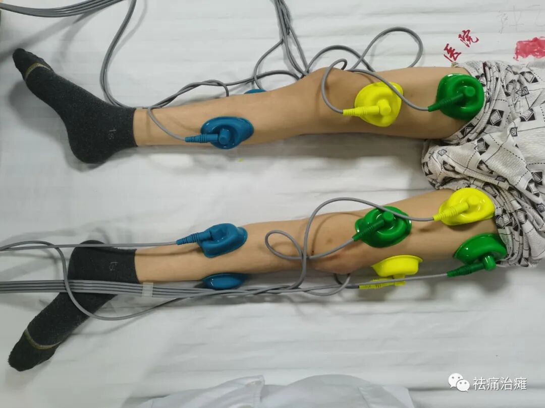 干扰治疗仪怎么使用干扰电治疗仪——“祛痛法宝”_https://www.jmylbn.com_新闻资讯_第2张