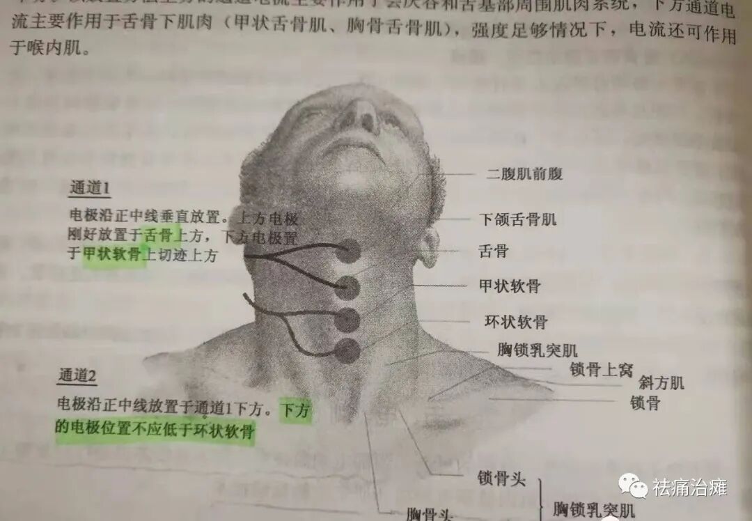 为什么要做吞咽仪器《康复科那些仪器》----“吞咽机”_https://www.jmylbn.com_新闻资讯_第9张