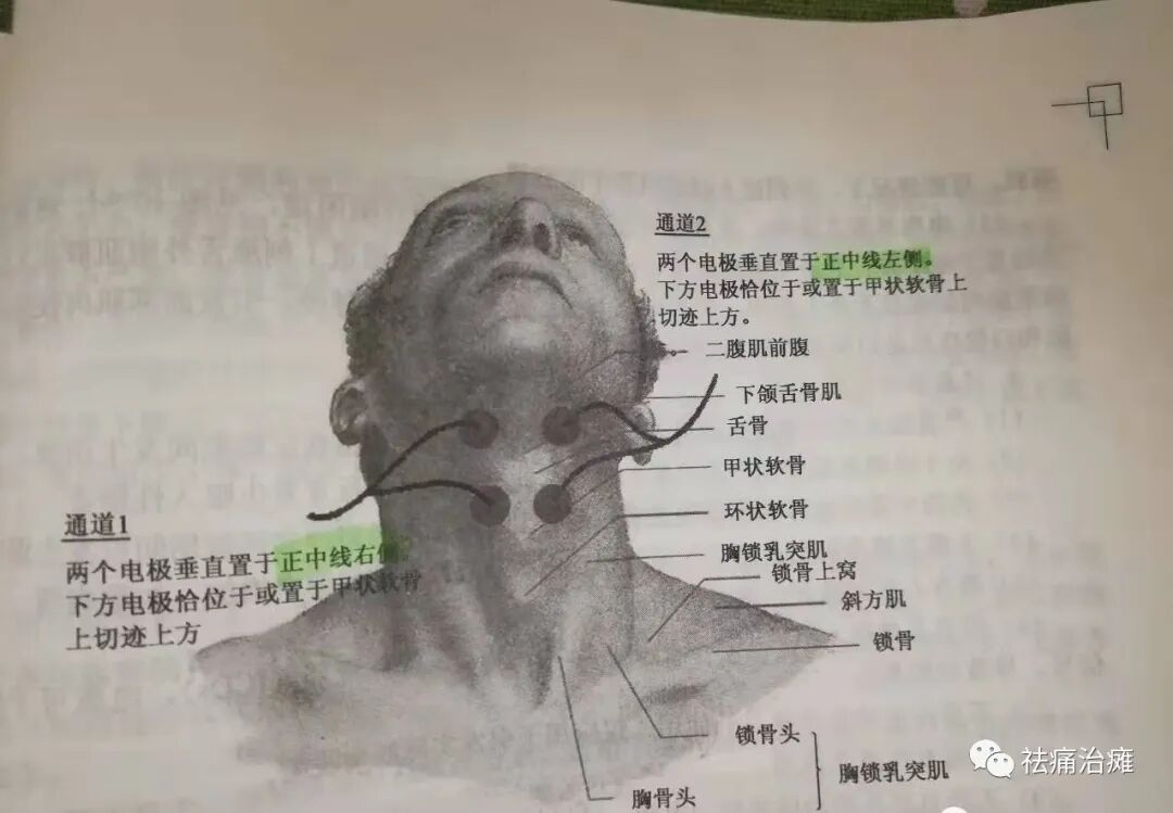 为什么要做吞咽仪器《康复科那些仪器》----“吞咽机”_https://www.jmylbn.com_新闻资讯_第11张