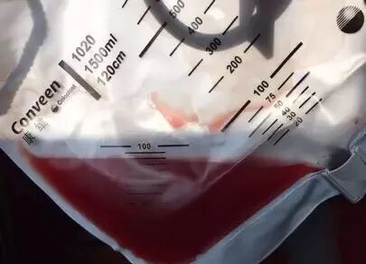 为什么新尿袋会漏尿你患者的尿管漏尿了吗？看过来~_https://www.jmylbn.com_新闻资讯_第4张