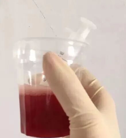 为什么新尿袋会漏尿你患者的尿管漏尿了吗？看过来~_https://www.jmylbn.com_新闻资讯_第5张