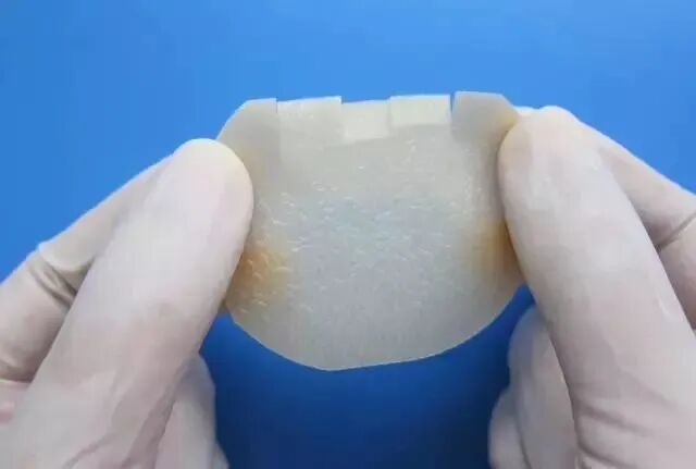 伤口贴敷料为什么护士，你贴的敷贴又卷边了？这里有八种敷贴固定技巧_https://www.jmylbn.com_新闻资讯_第2张