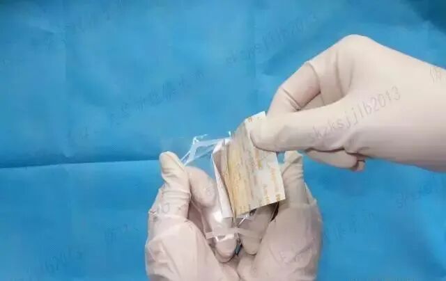 伤口贴敷料为什么护士，你贴的敷贴又卷边了？这里有八种敷贴固定技巧_https://www.jmylbn.com_新闻资讯_第19张