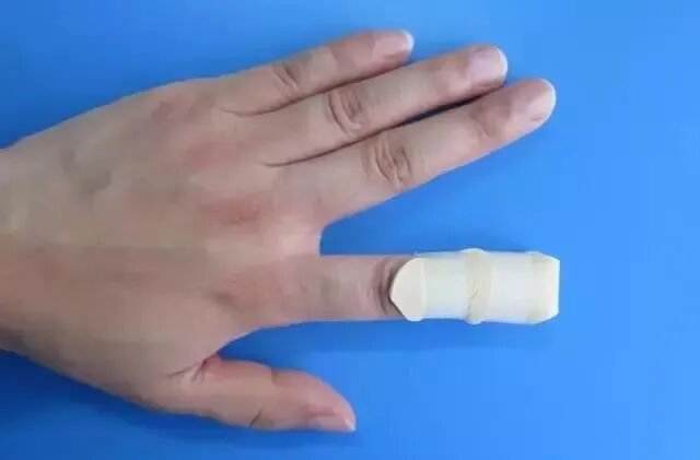 伤口贴敷料为什么护士，你贴的敷贴又卷边了？这里有八种敷贴固定技巧_https://www.jmylbn.com_新闻资讯_第11张